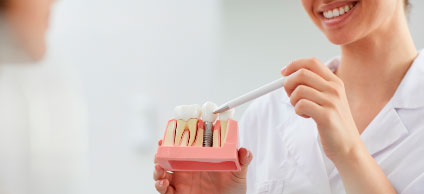 Odontóloga mostrando implantes