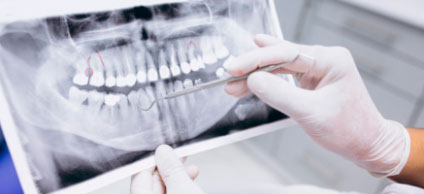 Radiografía dental