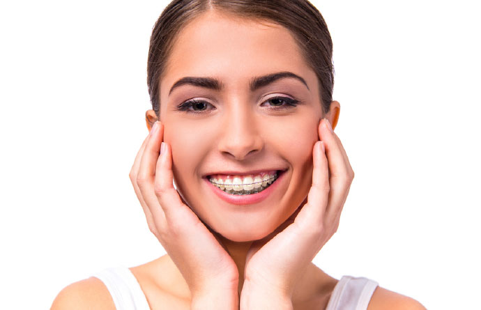 Imagen dientes con brackets